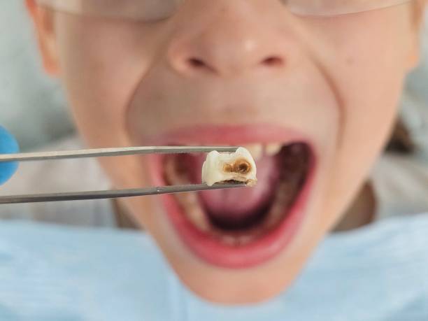 Best Knocked-Out Tooth Emergency  in Rose Hill, KS