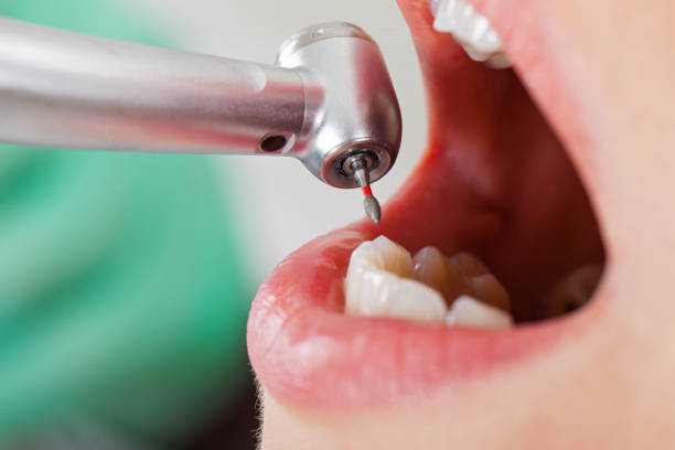 Best Knocked-Out Tooth Emergency  in Rose Hill, KS